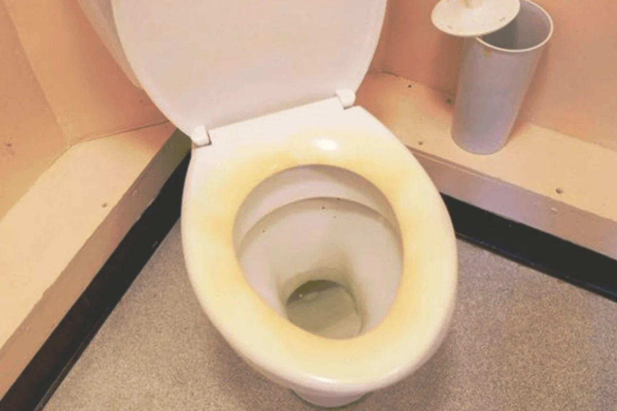 Vergilbter WC-Sitz, mit 2 Zutaten Rückenlehne weiß und glänzend